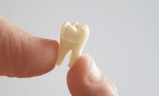 Root Canals in Crown Point Indiana