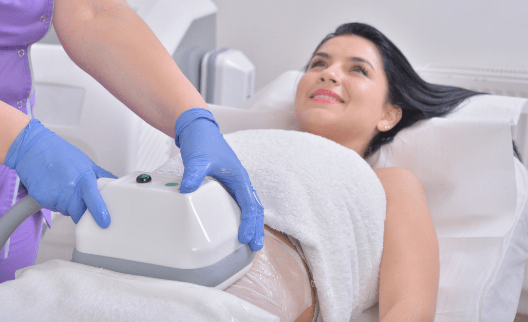 What is the best fat freezing machine