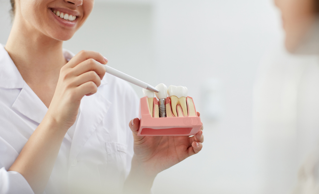 Dental Implant Surgery Recovery and Care Tips